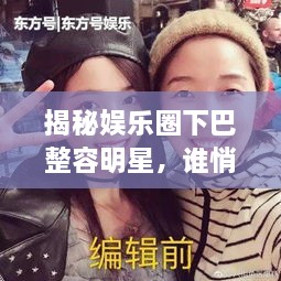 揭秘娛樂圈下巴整容明星，誰悄悄整過下巴？