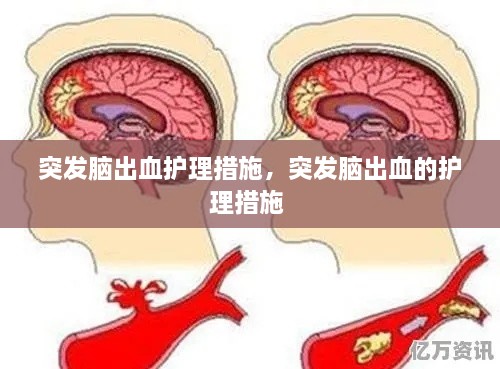 突發(fā)腦出血護理措施，突發(fā)腦出血的護理措施 