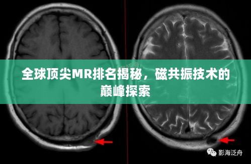 全球頂尖MR排名揭秘，磁共振技術(shù)的巔峰探索